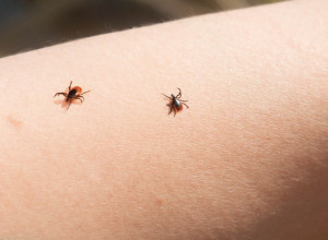 „Najopasnije je kada čovek ne zna da ga je ujeo krpelj“: Poslušajte savete stručnjaka, šta nikako ne treba da radite ukoliko primetite krpelja