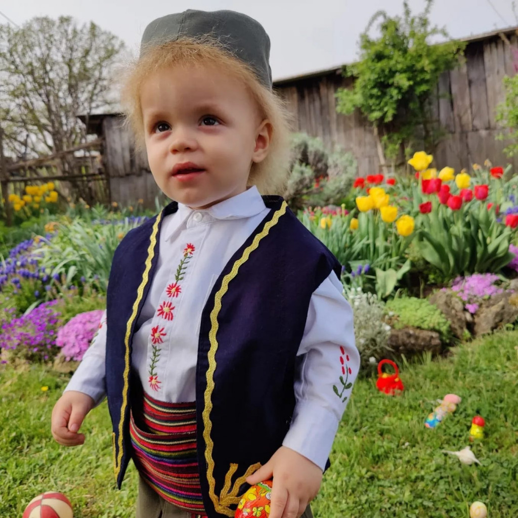 "LAVLJA GRIVA" IZ KRAGUJEVCA Ovaj simpatičan dečak je jedno od ukupno 100 dece na svetu sa "sindromom nekontrolisane kose" (FOTO/VIDEO)