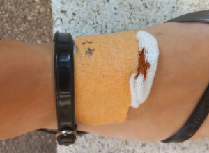 Osetila sam ujed, a onda videla krupnog pacova kako beži: Slavicu iz Čačka tokom šetnje pored Morave napao glodar