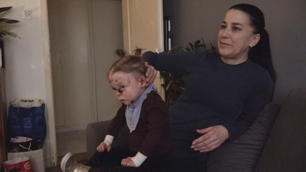 Uvek plače dok se kupa jer je boli - nadamo se da će sada biti lakše: Heriona koja brine o devojčici leptiru otkriva kako izgleda jedan dan malene Nađe