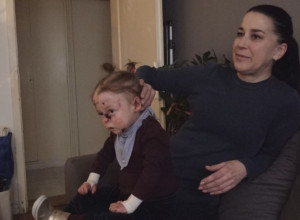 Uvek plače dok se kupa jer je boli - nadamo se da će sada biti lakše: Heriona koja brine o devojčici leptiru otkriva kako izgleda jedan dan malene Nađe